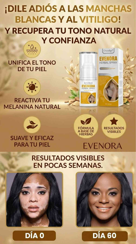 Oveallgo® Evenora Herbal Spray - ELIMINA EL VITILIGO Y RECUPERA TU SEGURIDAD
