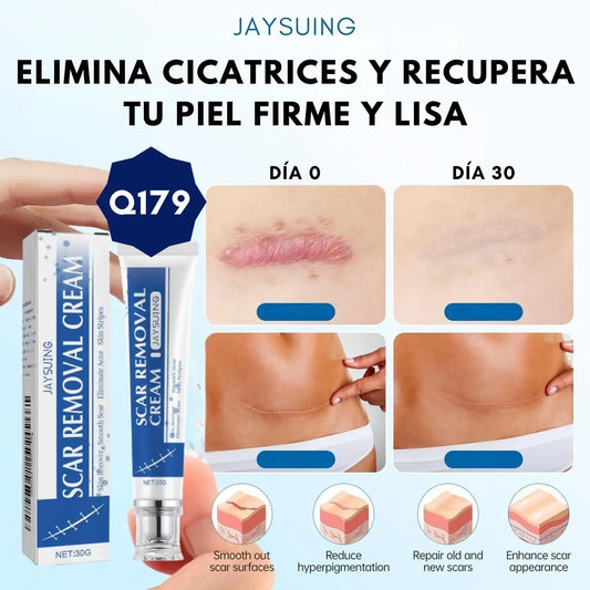 Scar Removal Cream - ELIMINA CUALQUIER TIPO DE CICATRICEZ