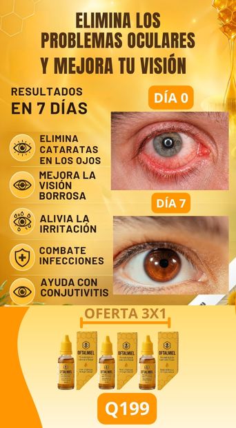 OFTALMIEL- Elimina las cataratas y mejora tu visón - 3X1..