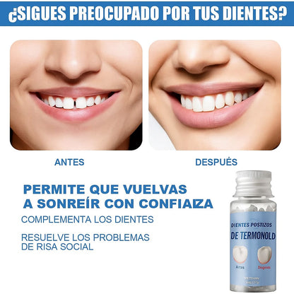 Perlas Reparación Dientes Postizos TeethGrow® |Dientes postisos instantaneos✨
