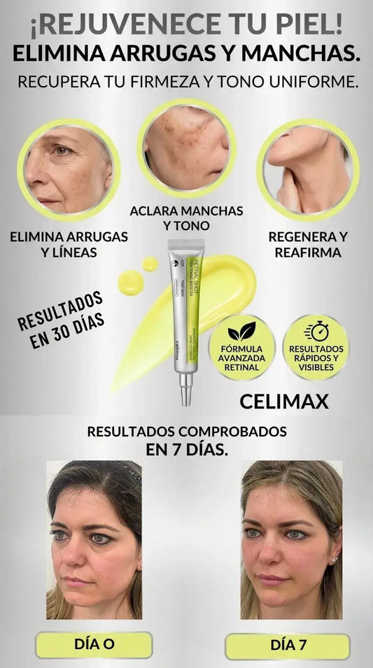 RETINAL SHOTS CELIMAX® ¡ELIMINA MANCHAS Y REJUVENECE TU PIEL!