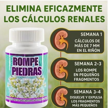 STONE DISSOLVER PLUS ® - SOLUCION NATURAL CONTRA LOS CALCULOS RENALES🌱