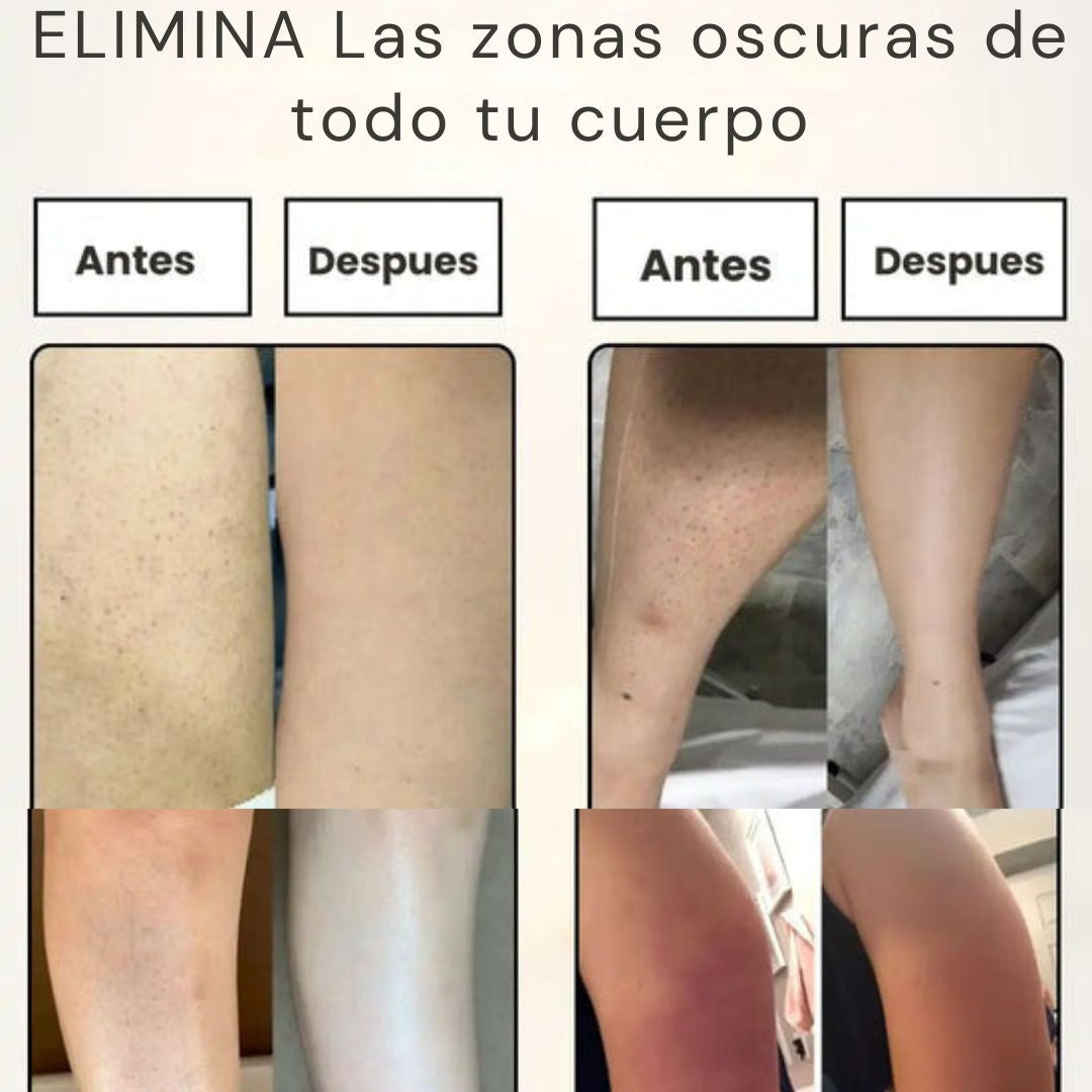 ÁCIDO GLICÓLICO 7% TONING SOLUTION DE THE ORDINARY®  – BLANQUEA TUS ZONAS OSCURAS